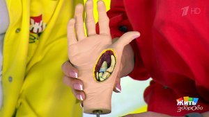 Ревматоидный артрит. Жить здорово! Фрагмент выпуска от 12.04.2019