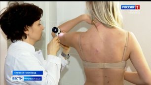 Пациентов с диагнозом рак кожи в Нижегородской области стало больше