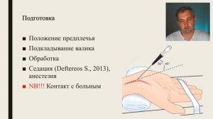 Катетеризация лучевой артерии