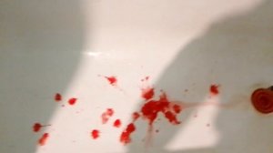 #говрек #яздохну #кровь у меня из-за рта кровь