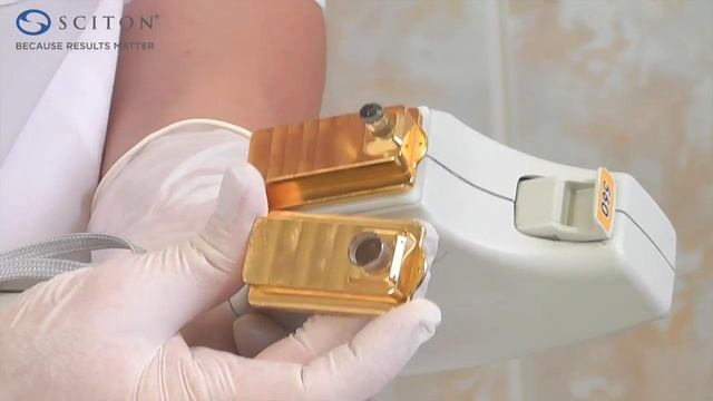 Процедура удаления гемангиомы с помощью широкополосного света BBL от Sciton смотреть онлайн