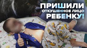 Пришил откушенное лицо ребенку! Жизнь врача после скандала