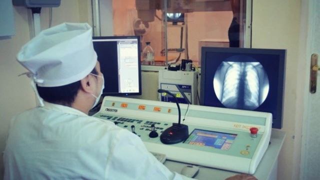 Что будет если СДЕЛАТЬ ФЛЮОРОГРАФИЮ 2 РАЗА ПОДРЯД смотреть онлайн