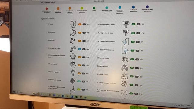 Разоблачение Канген воды! Как действует на организм? смотреть онлайн