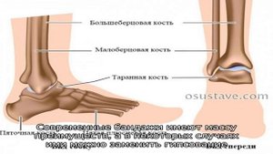 Бандажи для голеностопных суставов