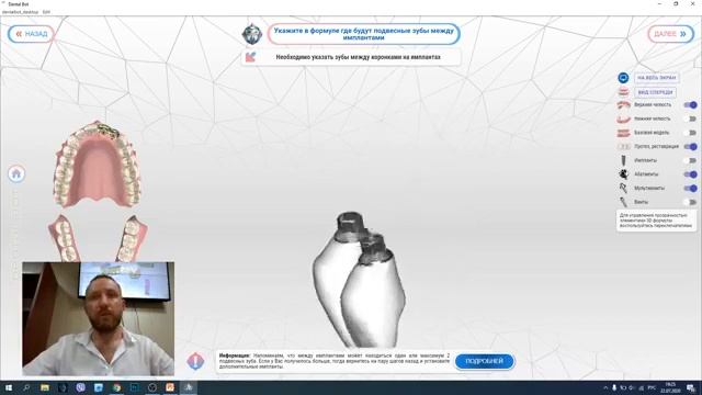 Вебинар - презентация Dental Bot смотреть онлайн