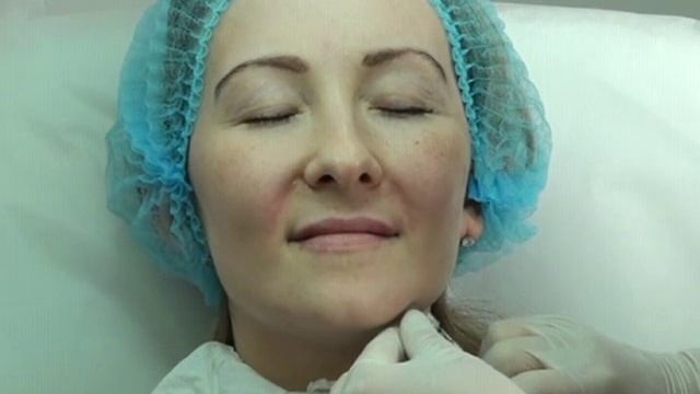 Контурная пластика Princess® Filler часть 3 смотреть онлайн