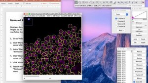 ImageJ Macro Cell Counter Instructional Video