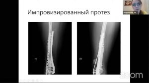 СНК 19.11.2020. ТЕМА "Детская онкология"