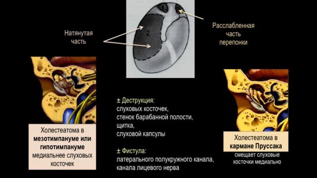 КТ ВИС 2 часть смотреть онлайн