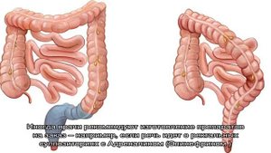 Как остановить геморроидальное кровотечение
