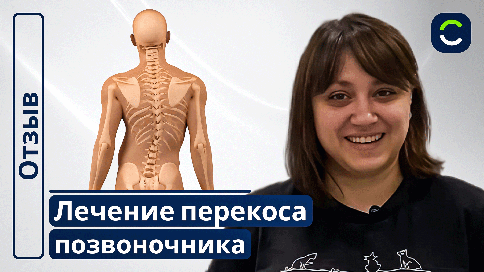 Лечение Перекоса Позвоночника | Отзывы Наших Пациентов