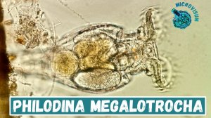 Philodina megalotrocha