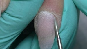 ЖЕСТЬ! Что делать? ЗАУСЕНЦЫ и ТРЕЩИНЫ на пальцах Мясистая кутикула Виктория Авдеева