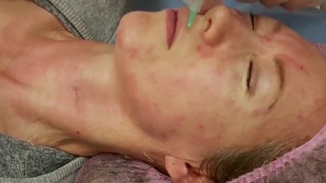 АирисКом студенты учатся: применение коктейлей для кожи лица при первых признаках старения.