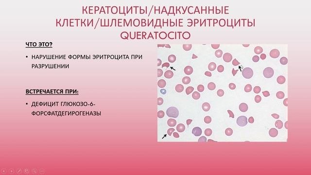 Формы эритроцитов и включения