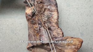 Рак легкого #2 - центральный рак легкого