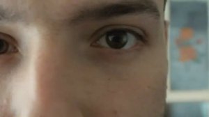 ОКАЛИНА ! ПОПАЛО В ГЛАЗ ! ШИРОКИЙ ЗРАЧОК