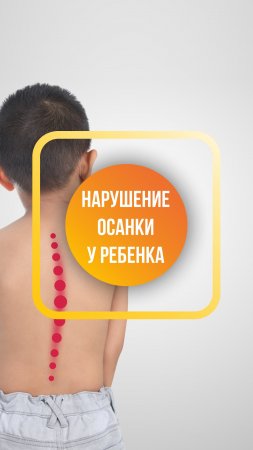 С чем связано нарушение осанки у ребенка?