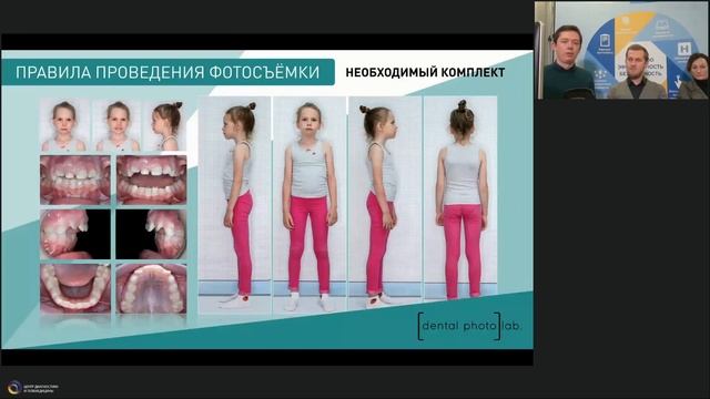 Комплексная миофункциональная диагностика с применением клинической фотографии