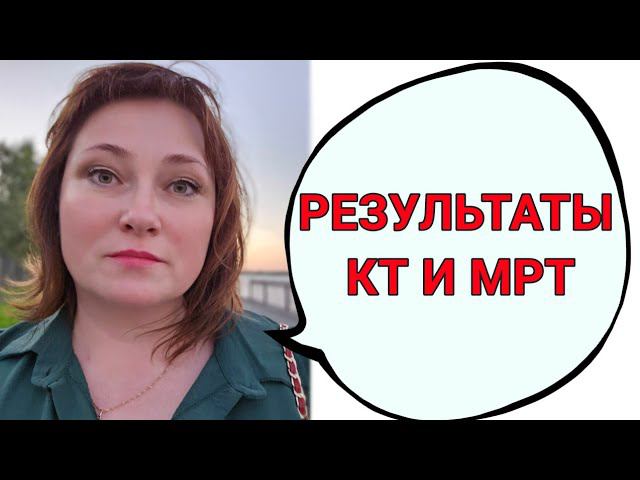 В Питере послали на Гамма-нож по результатам МРТ. Результаты КТ смотреть онлайн