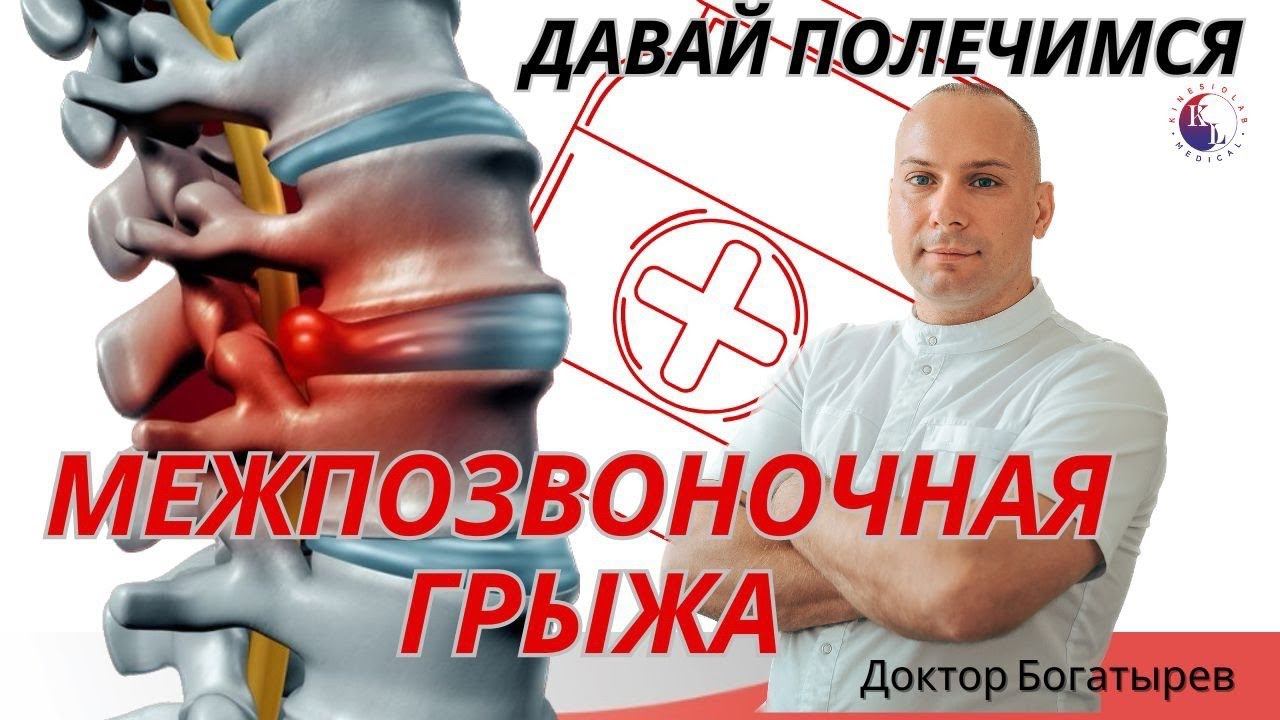 Межпозвоночная грыжа не приговор. Так ли эффективна операция? Как лечить грыжу?