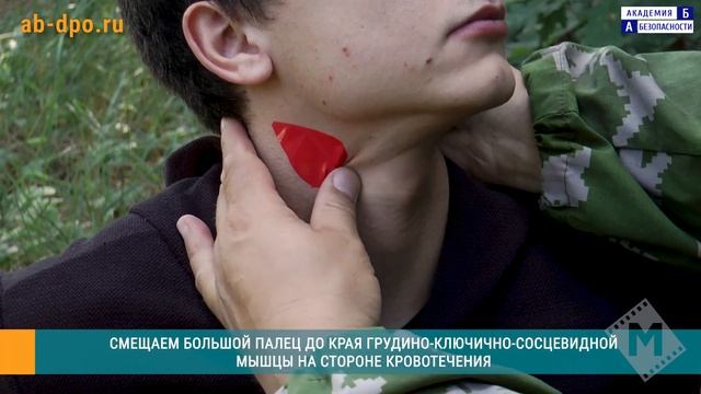 Остановка кровотечения из сонной артерии прижатием. Способ №2
