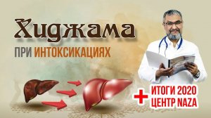 ХИДЖАМА ПРИ ИНТОКСИКАЦИЯХ: МЕХАНИЗМ ВОЗДЕЙСТВИЯ / 4 МИФА О ХИДЖАМЕ / ПОДВЕДЕНИЕ ИТОГОВ 2020 ГОДА