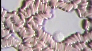 Нити фибриногена (фибрина) под микроскопом | Filaments of fibrinogen (fibrin) under the microscope