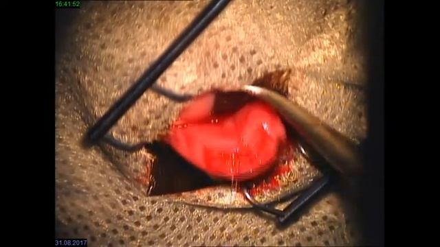 Залом ножки хряща 3его века в 2 местах смотреть онлайн