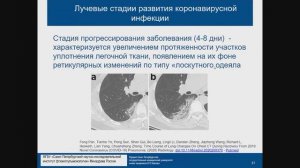 КТ диагностика поражения легких при COVID 19 Лукина О.В.