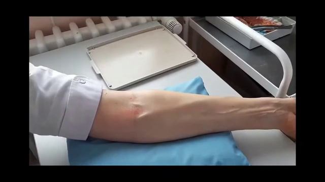 инъекция Эссенциале