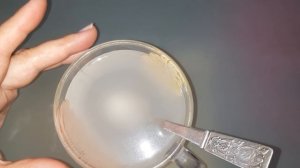 МОЧЕВАЯ КИСЛОТА  Как ВЫВЕСТИ  ИЗ  ОРГАНИЗМА !