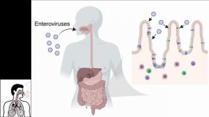 Полиовирус (Enterovirus C) - Полимиелит: Морфология, Цикл, Патогенез, Диагностика, Профилактика