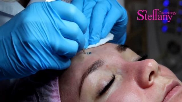 Чистка лица смотреть онлайн