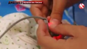Диагноз Пелена на глазах