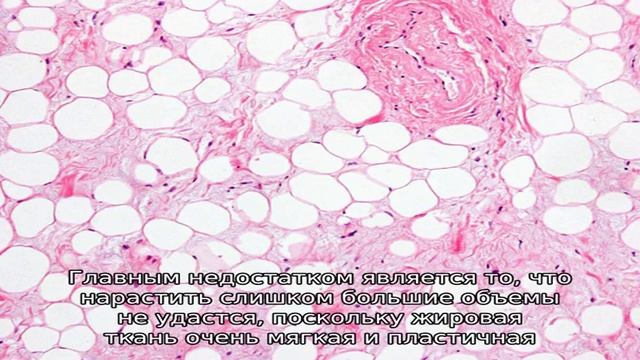 Липофилинг ног сделает их идеальными смотреть онлайн