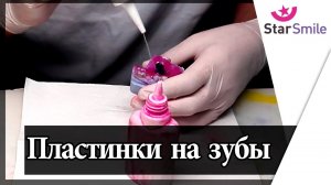 Изготовление пластинки для расширения челюсти -  старые технологии лечения прикуса
