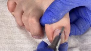 БОЛЯТ НОГТИ?Аппаратный педикюр на себе в домашних условиях