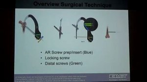 Практикум по интрамедуллярному остеосинтезу проксимального отдела бедренной кости