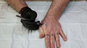 Самостоятельная установка NFC или RFID чипа (тэга; импланта)