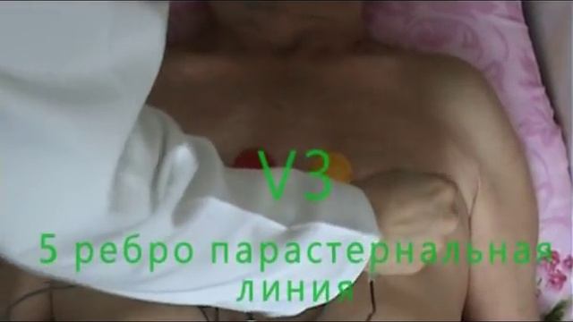 Методика регистрации ЭКГ смотреть онлайн