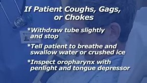 Введение назогастрального зонда в желудок