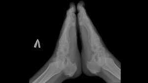 Укладка для снимка стопы