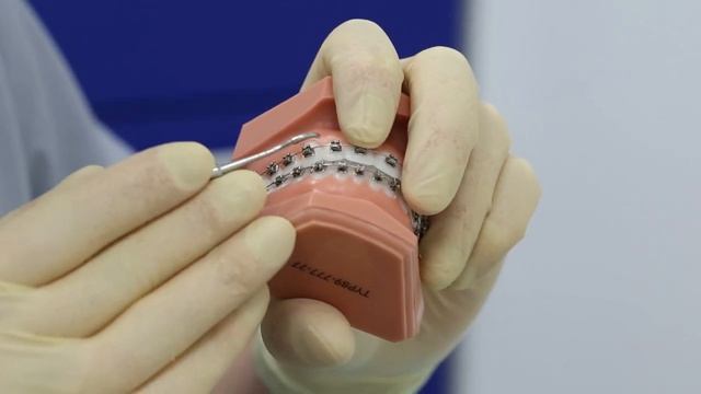 №6.Что делать если отклеился брекет смотреть онлайн