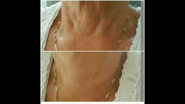 КРАСИВАЯ ЗОНА ШЕИ И ДЕКОЛЬТЕ