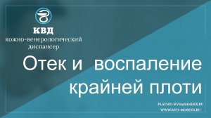 307  Отек и воспаление крайней плоти