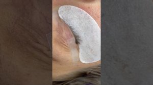 Подтяжка века. Скотч наращивание ресниц