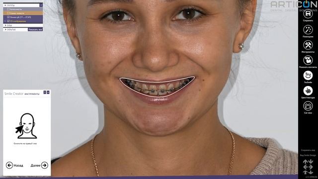 Презентация EXOCAD SMILE CREATOR (DENTAL-EXPO 2019) смотреть онлайн