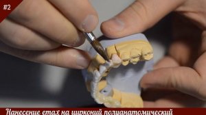 Нанесение керамики emax на циркониевый каркас! Изготовление циркониевых коронок.